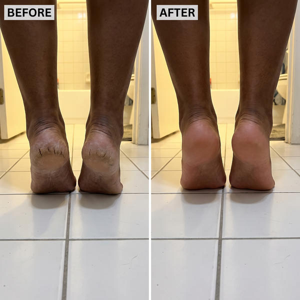 Before After 1