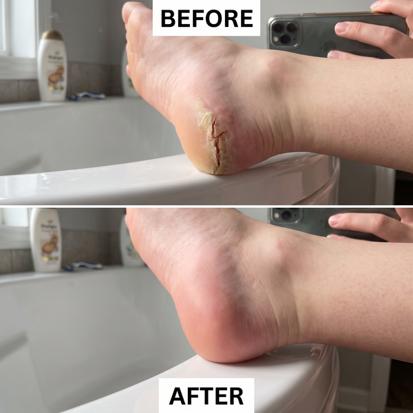 Before After 2